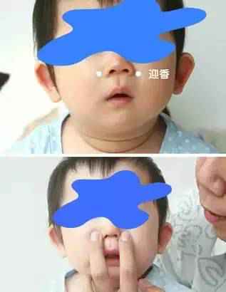 母婴篇:宝宝鼻塞 感冒 咳嗽 腹胀 积食 盗汗 夜啼？图解实用小儿推拿大全帮你！