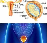 子宫发育不良平时需要注意哪些方面?