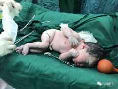 产房系列：为什么出生后就要母婴皮肤接触